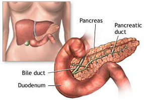 Sintomi del diabete: Produzione insufficiente di insulina dal pancreas