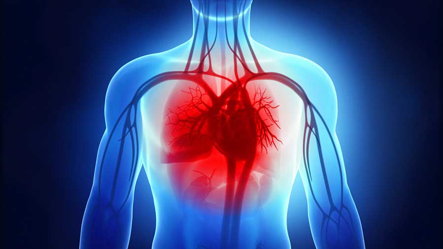 L’insufficienza cardiaca: una complicanza del diabete sottostimata